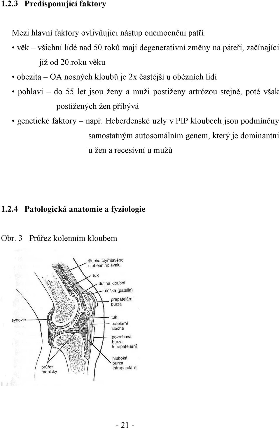 roku věku obezita OA nosných kloubů je 2x častější u obézních lidí pohlaví do 55 let jsou ženy a muži postiženy artrózou stejně, poté však