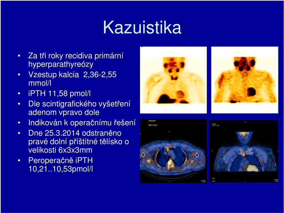 Indikován k operačnímu řešení Dne 25.3.