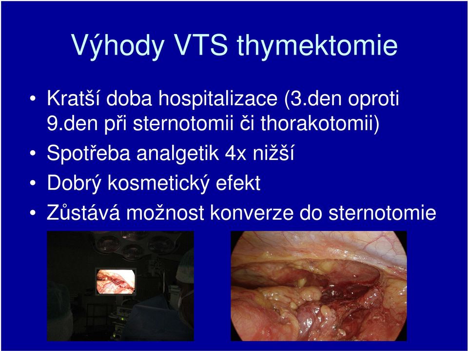 den při sternotomii či thorakotomii) Spotřeba