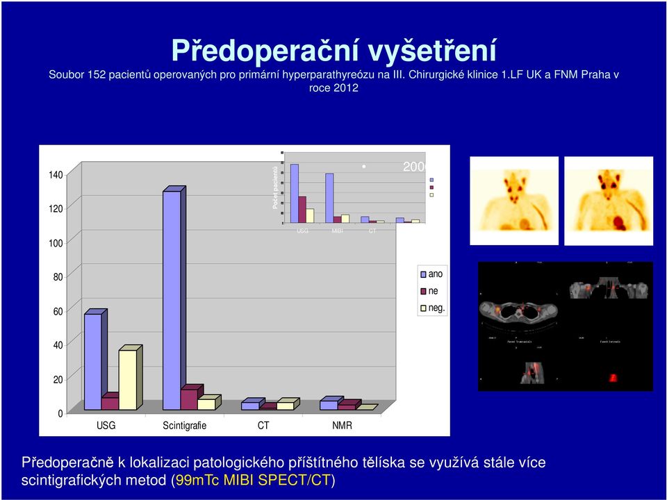 LF UK a FNM Praha v roce 2012 140 120 Počet pacientů 70 60 50 40 30 20 10 2006 TP FP FN 100 0 USG