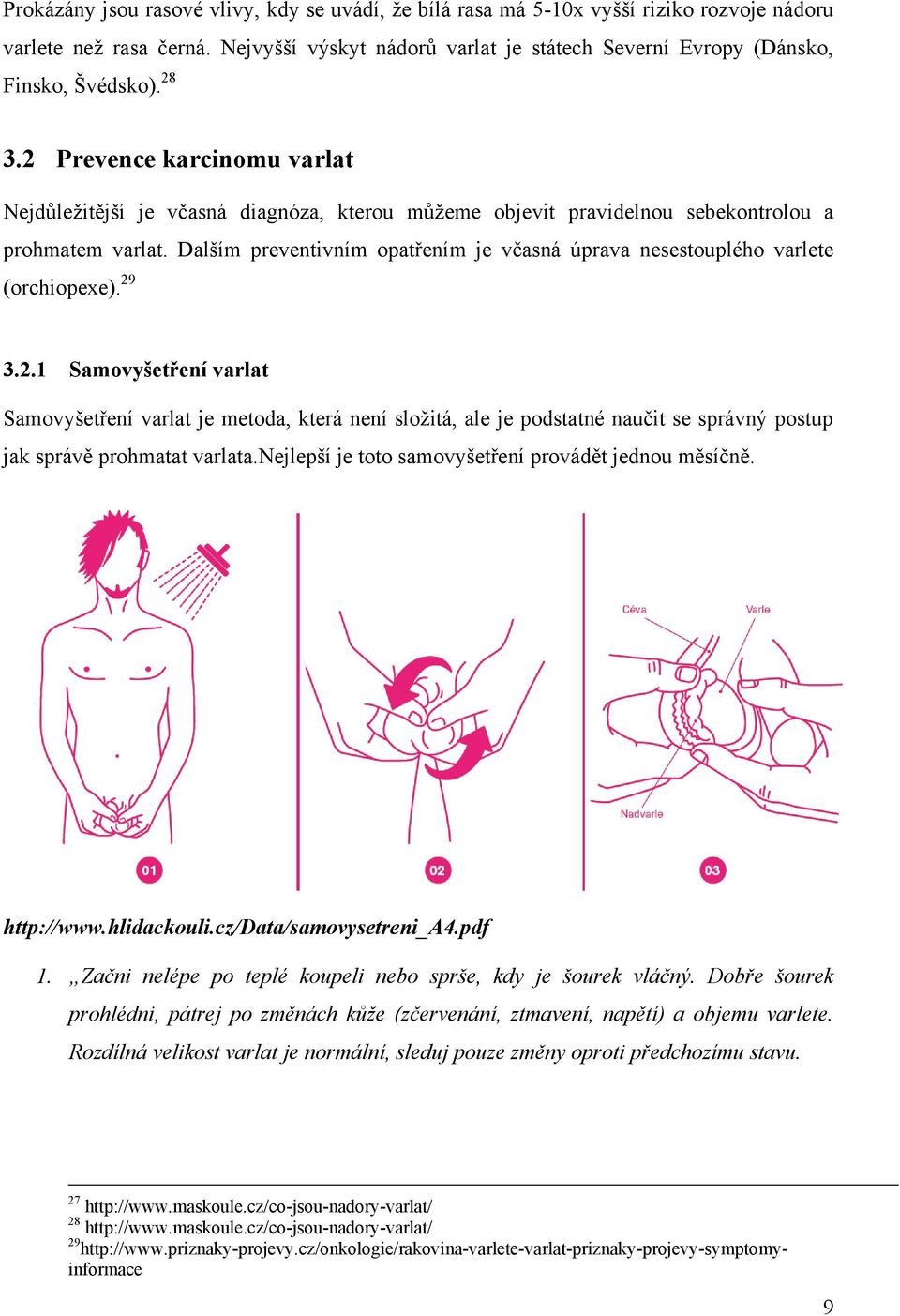 Dalším preventivním opatřením je včasná úprava nesestouplého varlete (orchiopexe). 29