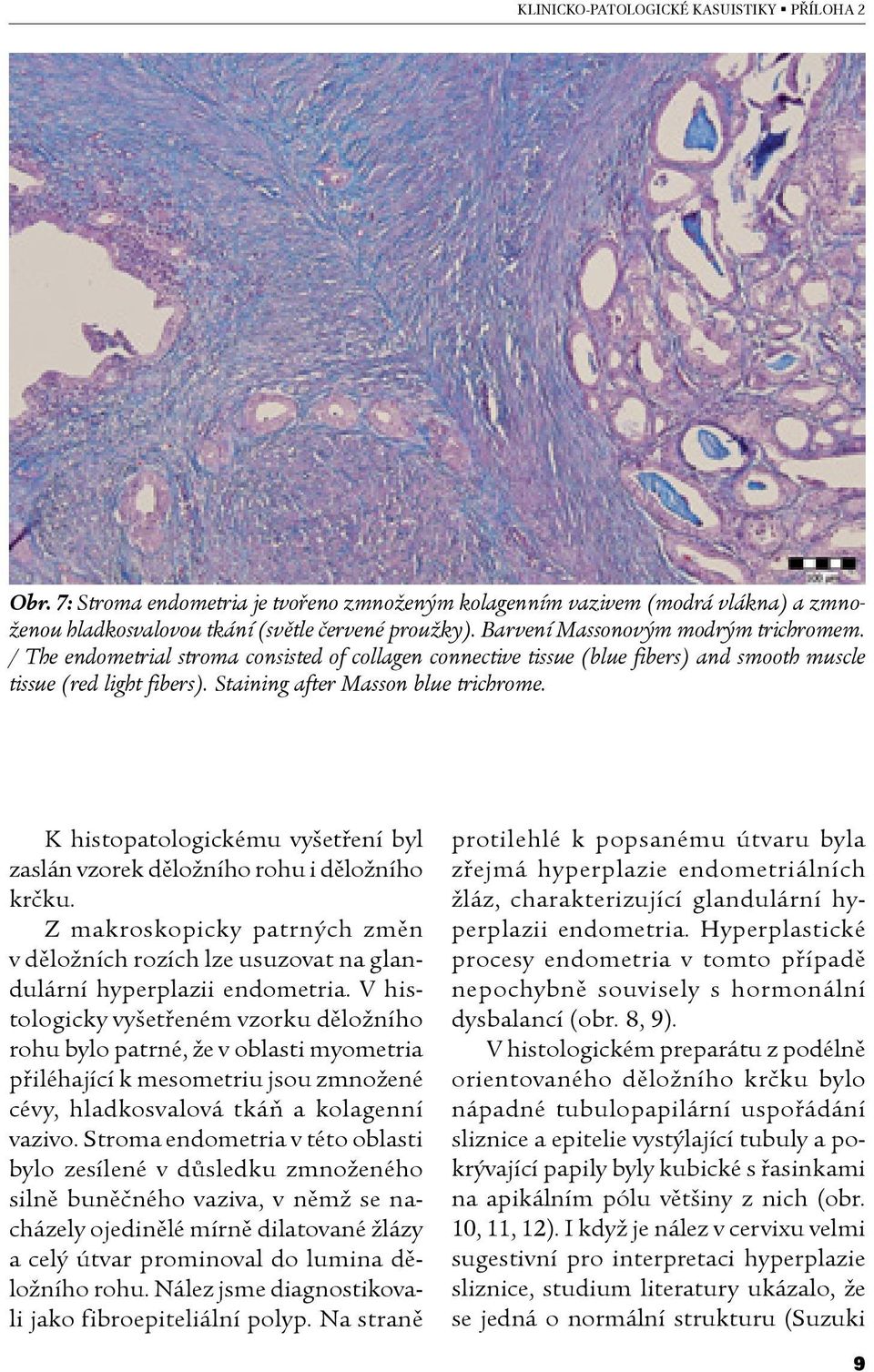 K histopatologickému vyšetření byl zaslán vzorek děložního rohu i děložního krčku. Z makroskopicky patrných změn v děložních rozích lze usuzovat na glandulární hyperplazii endometria.