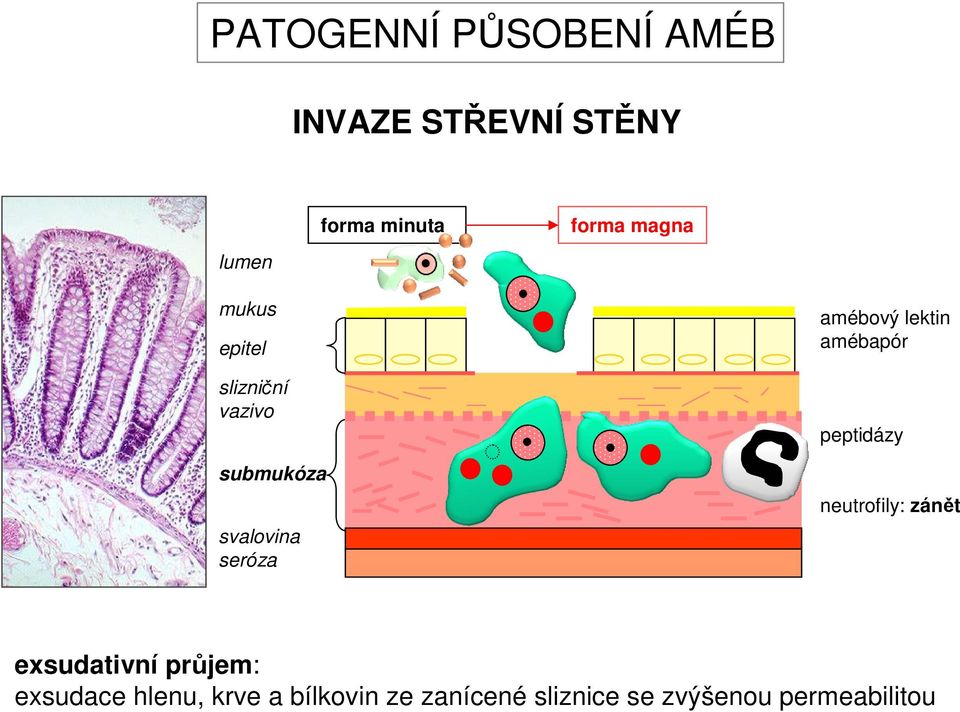 lektin amébapór peptidázy neutrofily: zánět exsudativní průjem: