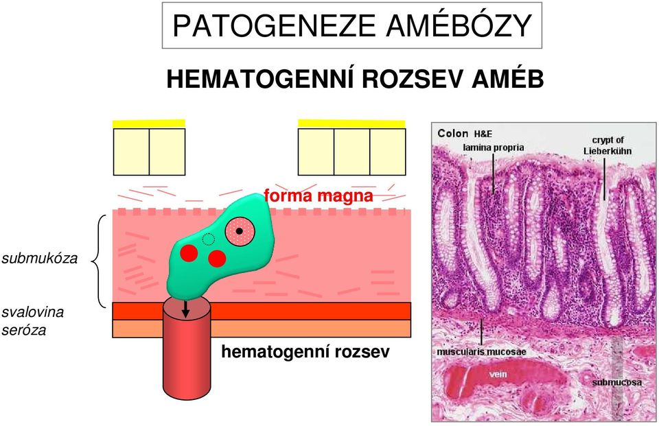 forma magna submukóza