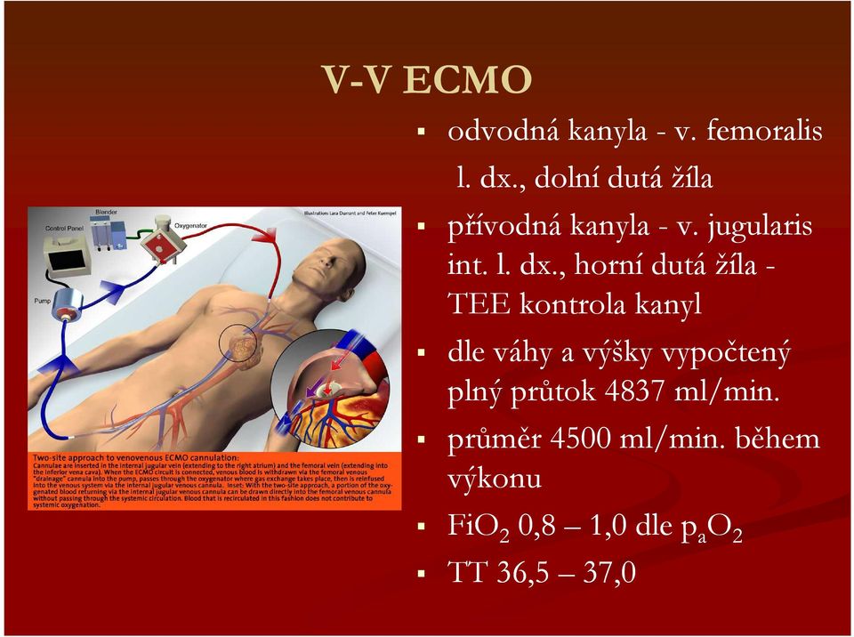 , horní dutá žíla - TEE kontrola kanyl dle váhy a výšky vypočtený