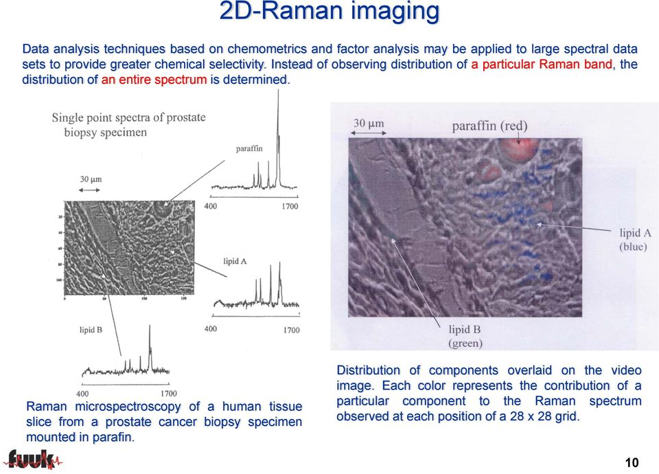 Raman microspectroscopy of a human tissue slice from a prostate cancer biopsy specimen mounted in parafin.