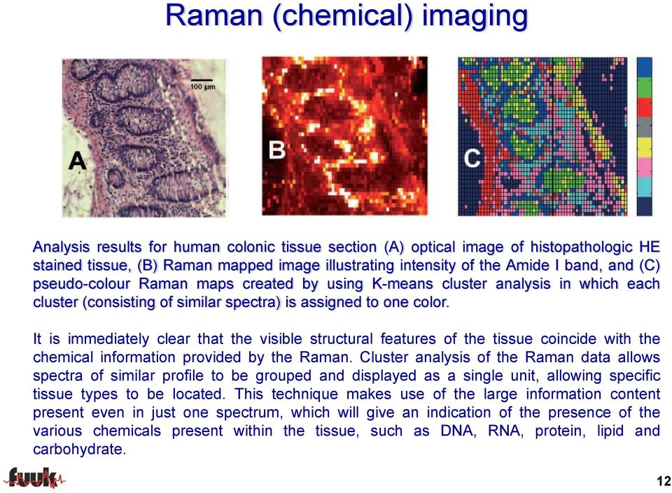 It is immediately clear that the visible structural features of the tissue coincide with the chemical information provided by the Raman.