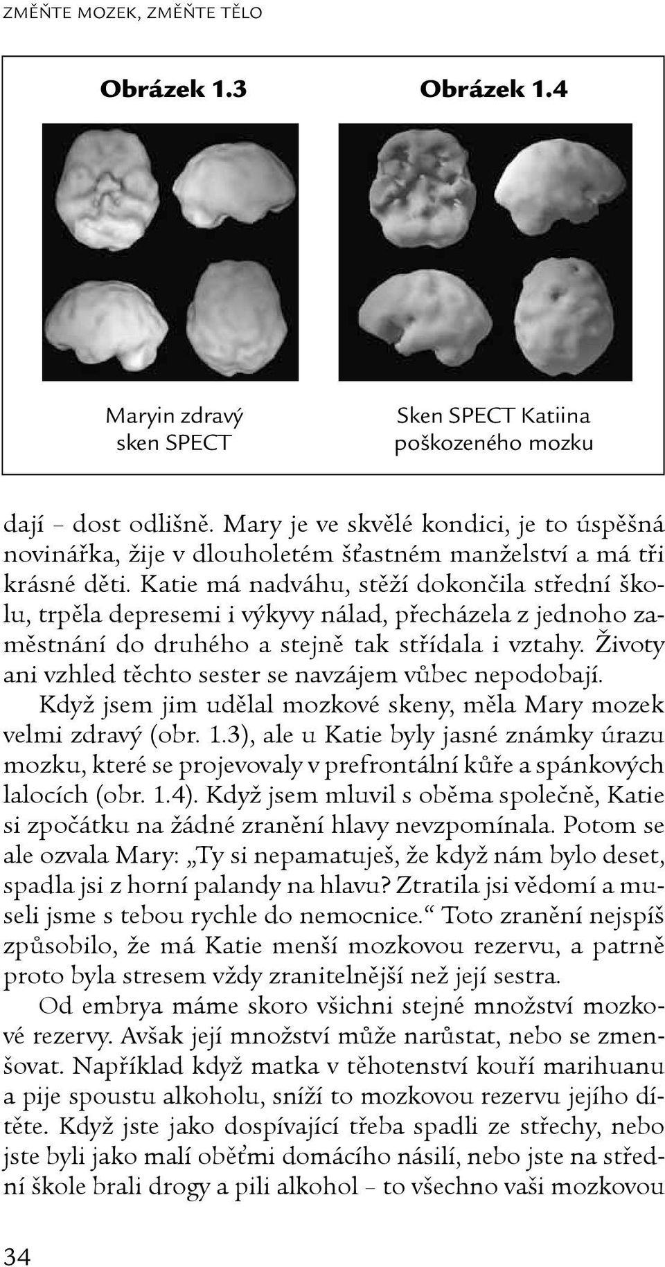 Katie má nadváhu, stěží dokončila střední školu, trpěla depresemi i výkyvy nálad, přecházela z jednoho zaměstnání do druhého a stejně tak střídala i vztahy.