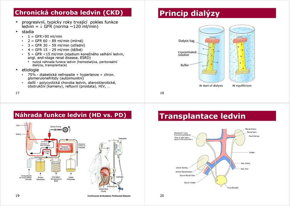 end-stage renal disease, ESRD) nutná náhrada funkce ledvin (hemodialýza, peritoneální dialýza, transplantace) etiologie 75% - diabetická nefropatie + hypertenze + chron.