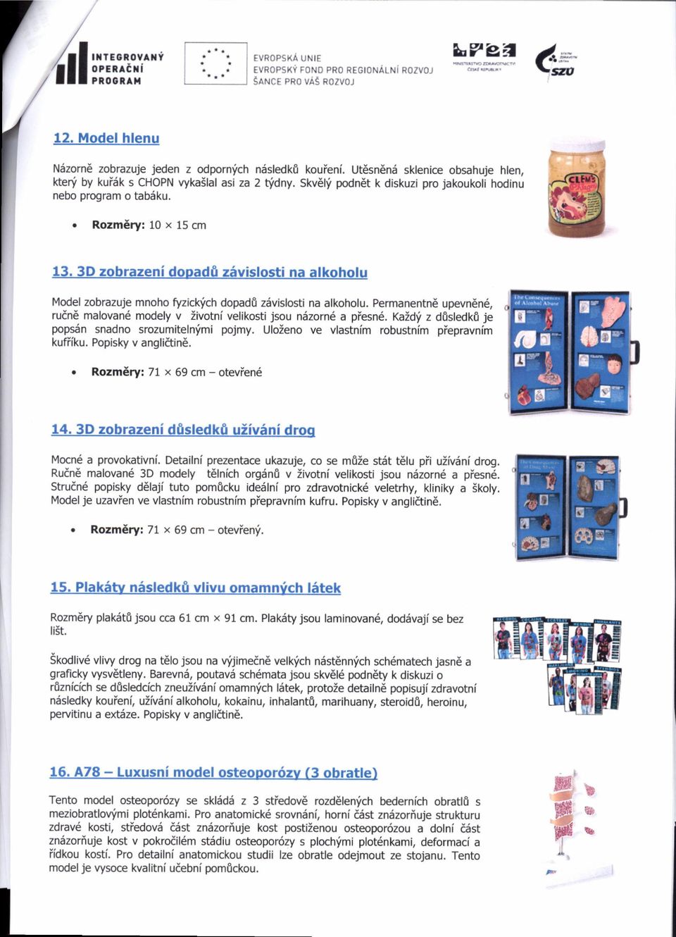 3D zobrazeni dooad& z5vislosti na alkoholu Model zobrazuje mnoho fyzich!'ch dopadfi zsvislosti na alkoholu. Permanentn6 upevn6n6, rudnd malovane modely v Zivotni velikosti jsou n5zorn6 a piesn6.