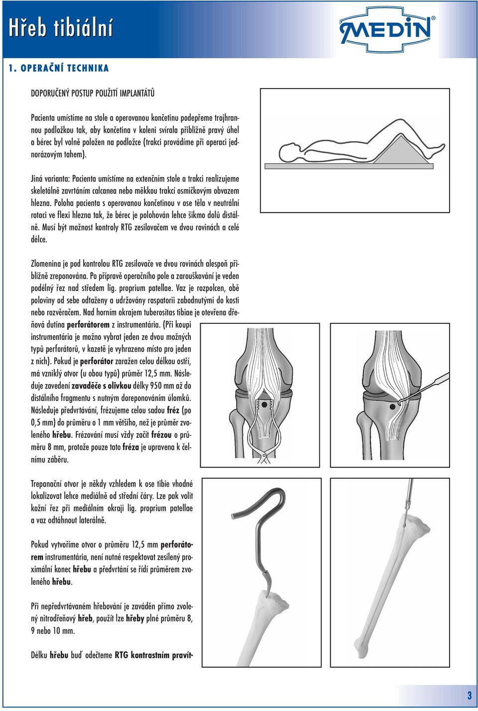 Jiná varianta: Pacienta umístíme na extenčním stole a trakci realizujeme skeletálně zavrtáním calcanea nebo měkkou trakcí osmičkovým obvazem hlezna.