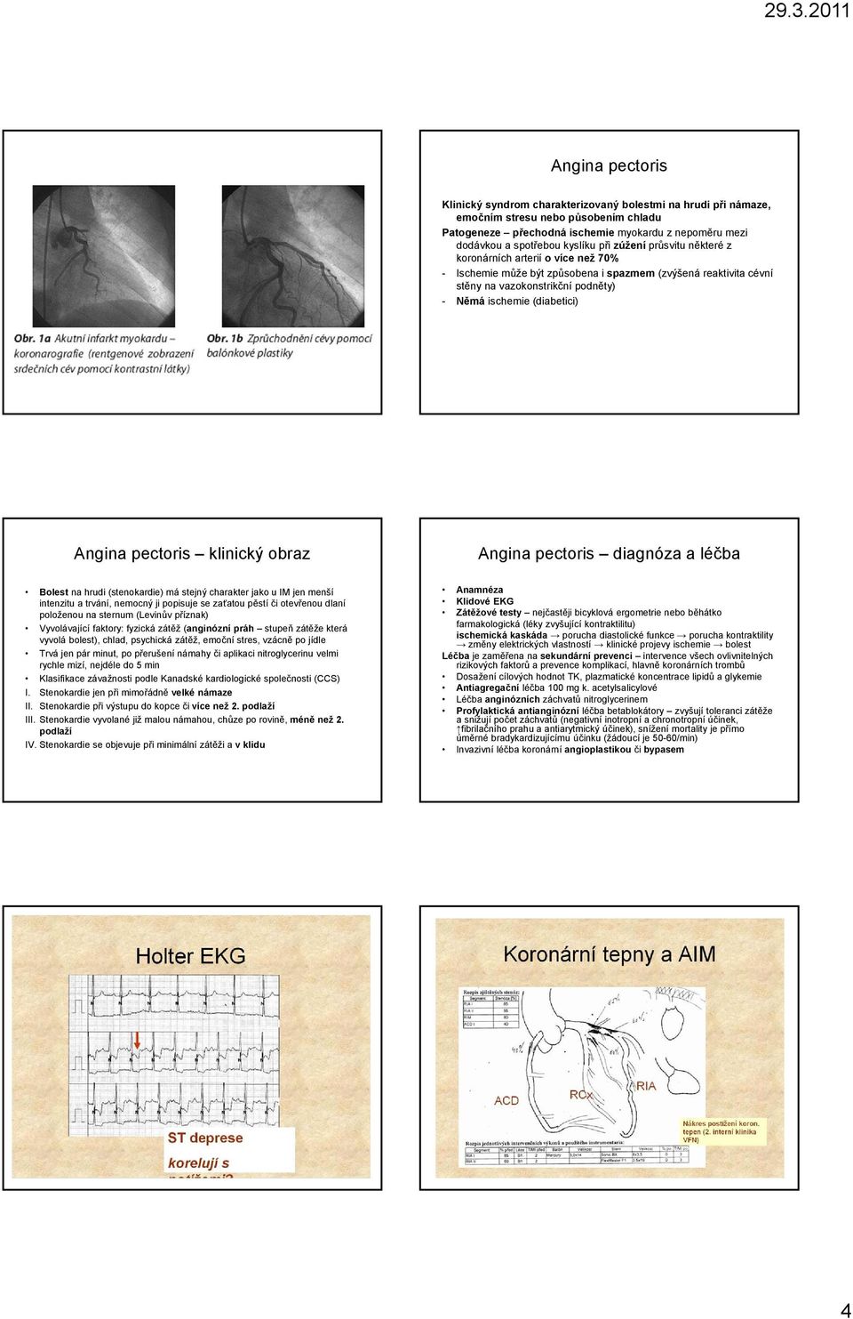 (diabetici) Angina pectoris klinický obraz Angina pectoris diagnóza a léčba Bolest na hrudi (stenokardie) má stejný charakter jako u IM jen menší intenzitu a trvání, nemocný ji popisuje se zaťatou