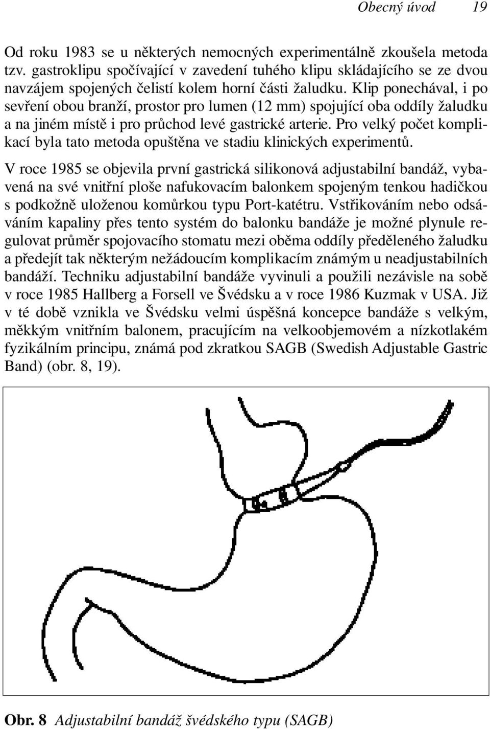 Klip ponechával, i po sevření obou branží, prostor pro lumen (12 mm) spojující oba oddíly žaludku a na jiném místě i pro průchod levé gastrické arterie.