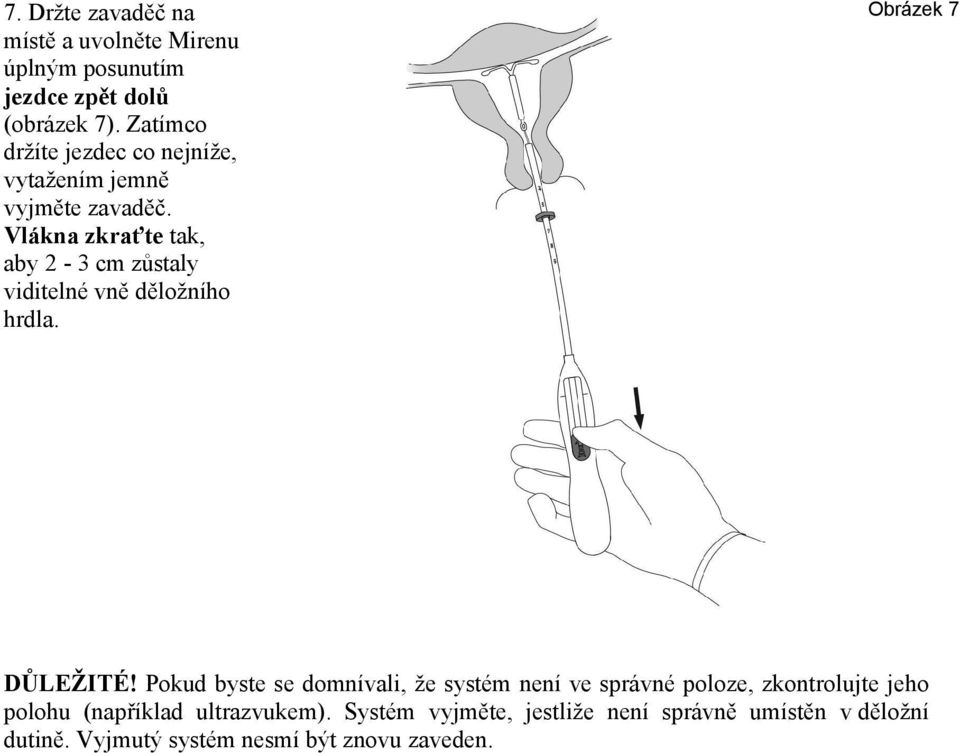 Vlákna zkraťte tak, aby 2-3 cm zůstaly viditelné vně děložního hrdla. Obrázek 7 DŮLEŽITÉ!