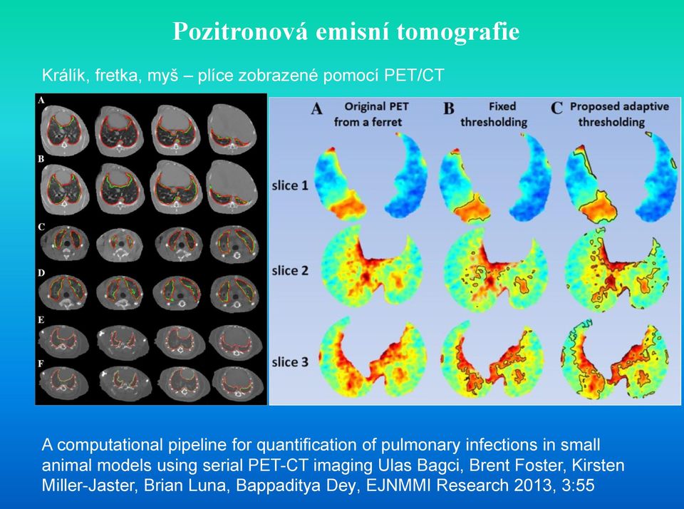 models using serial PET-CT imaging Ulas Bagci, Brent Foster,