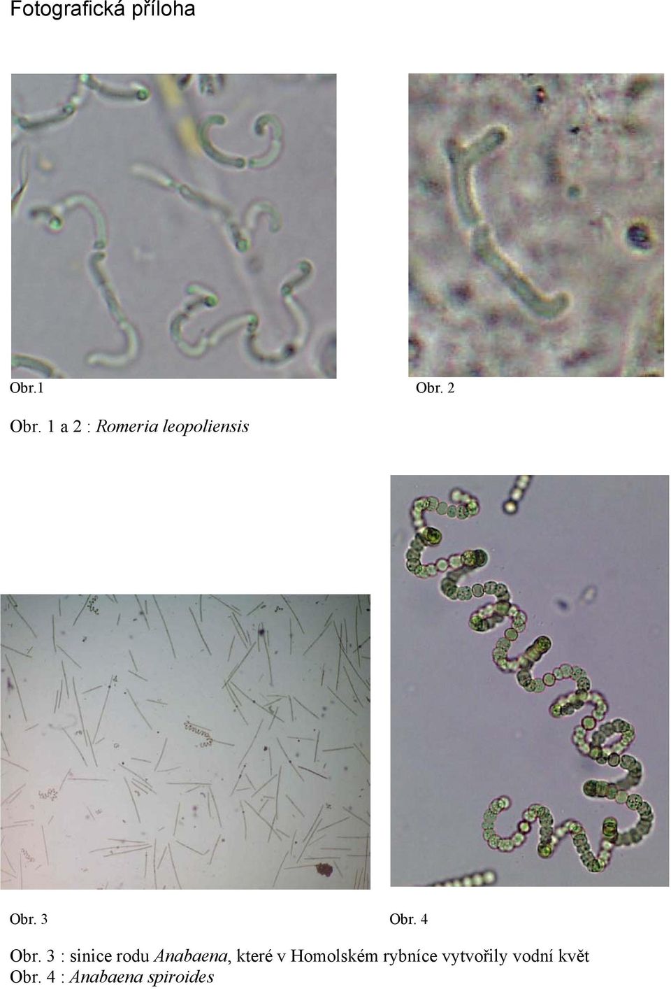 3 : sinice rodu Anabaena, které v Homolském
