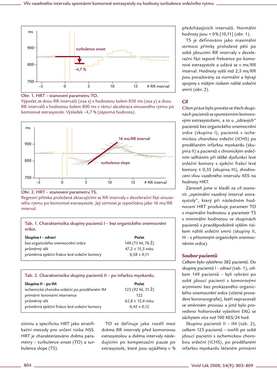 Výsledek 4,7 % (záporná hodnota). Obr. 2. HRT stanovení parametru TS. Regresní přímka proložená zkracujícími se RR intervaly v decelerační fázi sinusového rytmu po komorové extrasystole.