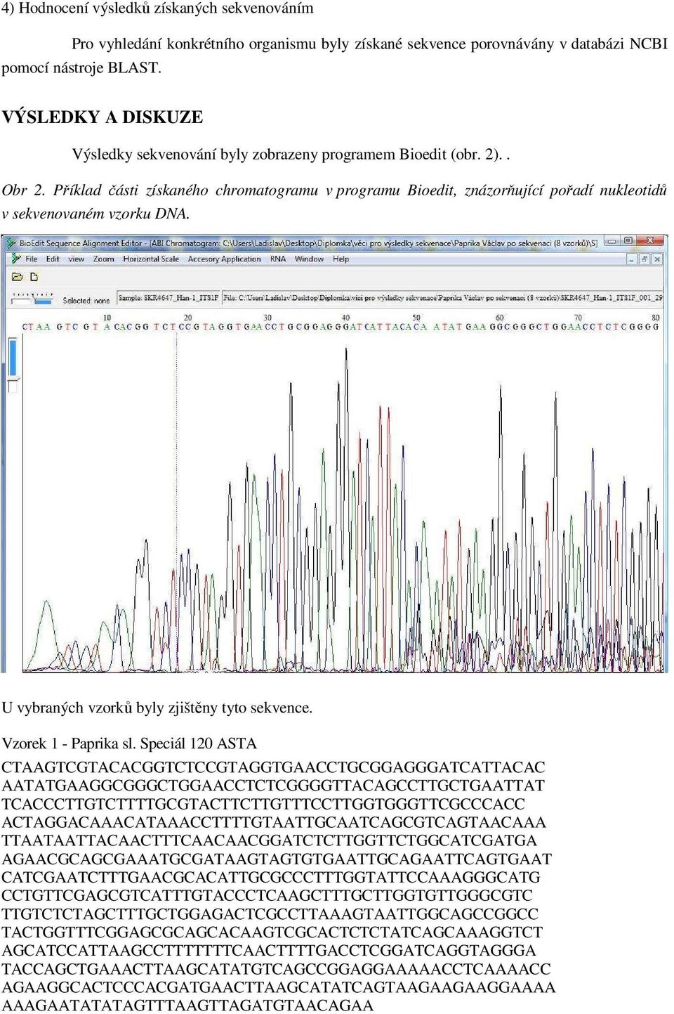 Příklad části získaného chromatogramu v programu Bioedit, znázorňující pořadí nukleotidů v sekvenovaném vzorku DNA. U vybraných vzorků byly zjištěny tyto sekvence. Vzorek 1 - Paprika sl.