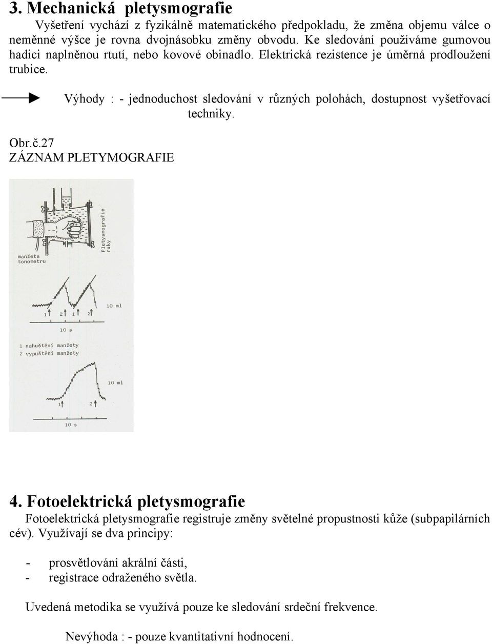 Výhody : - jednoduchost sledování v různých polohách, dostupnost vyšetřovací techniky. Obr.č.27 ZÁZNAM PLETYMOGRAFIE 4.