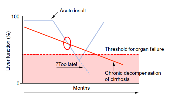 Acute-on chronic liver failure ACLF akutní zhoršení stávajícího, chronického onemocnění jater, obvykle související s precipitující