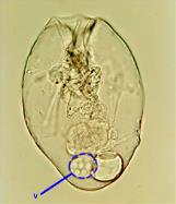 Zástupci vířníci - Rotifera buchanky - Copepoda perloočky - Cladocera Rotifera - vířníci Podobní nálevníkům, ale mnohobuněční Charakteristickými orgány jsou Vířivý orgán na přídi těla Mastax žvýkadlo