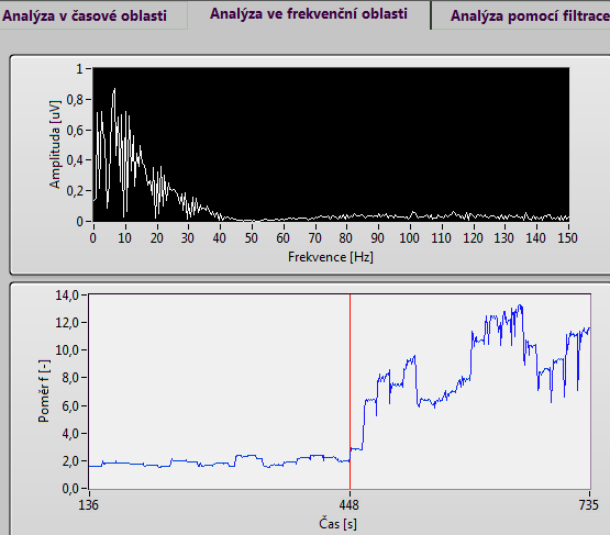 Obr. 56 Čelní panel - frekvenční oblast Obr. 56 znázorňuje část čelního panelu uživatelského prostředí se zobrazením výsledků analýzy ve frekvenční oblasti. Na následujícím Obr.