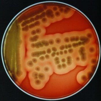 Bacillus cereus Bacillus cereus je znám především jako významný původce kažení potravin. Na začátku 20.