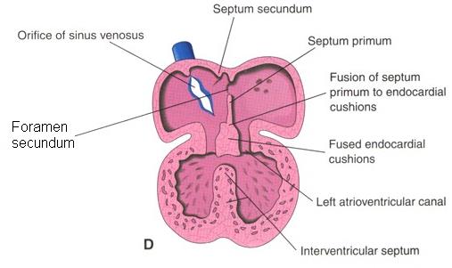 Septace embryonální komory komorová přepážka pars muscularis