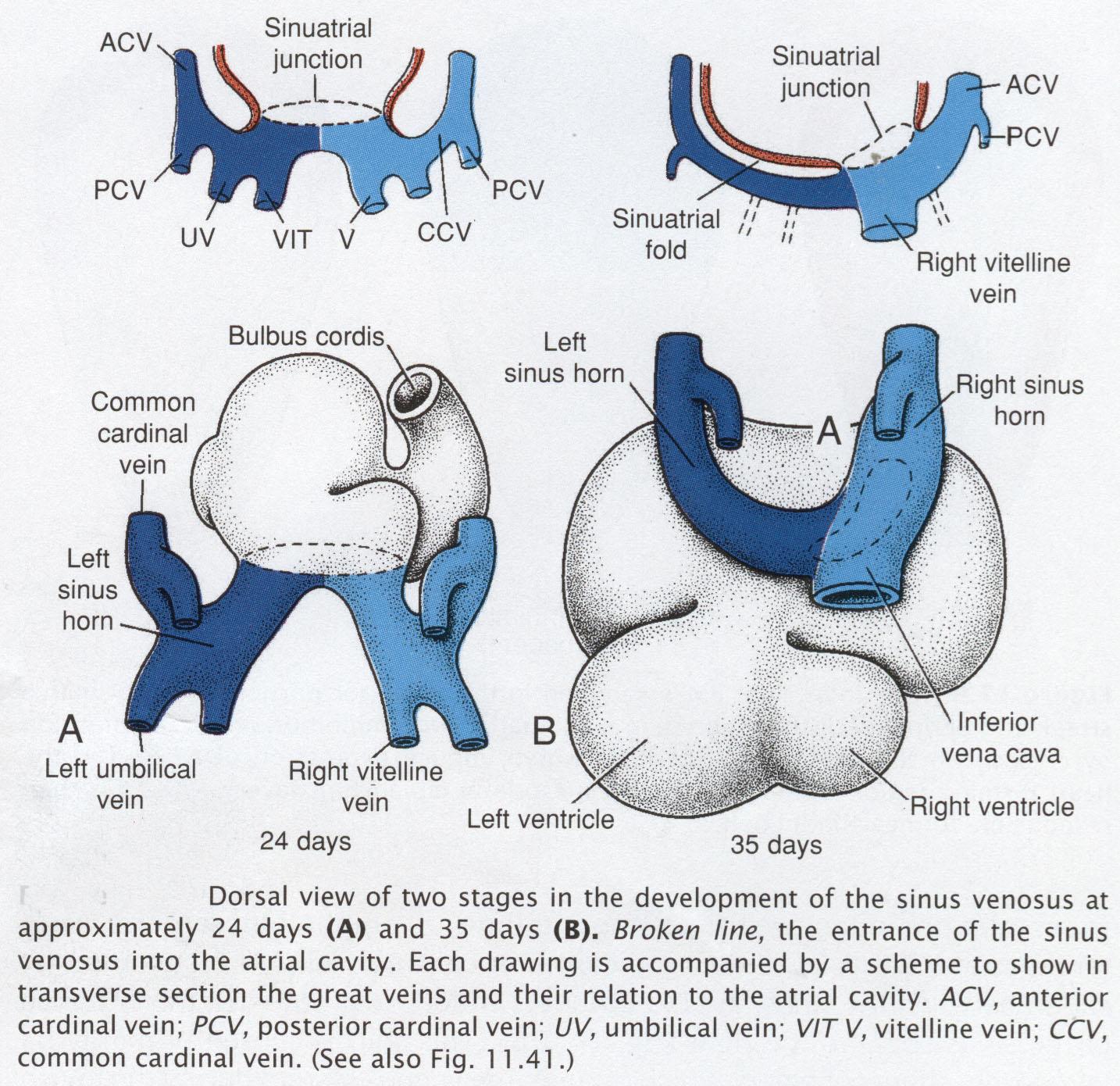 Sinus venosus 4.-5.