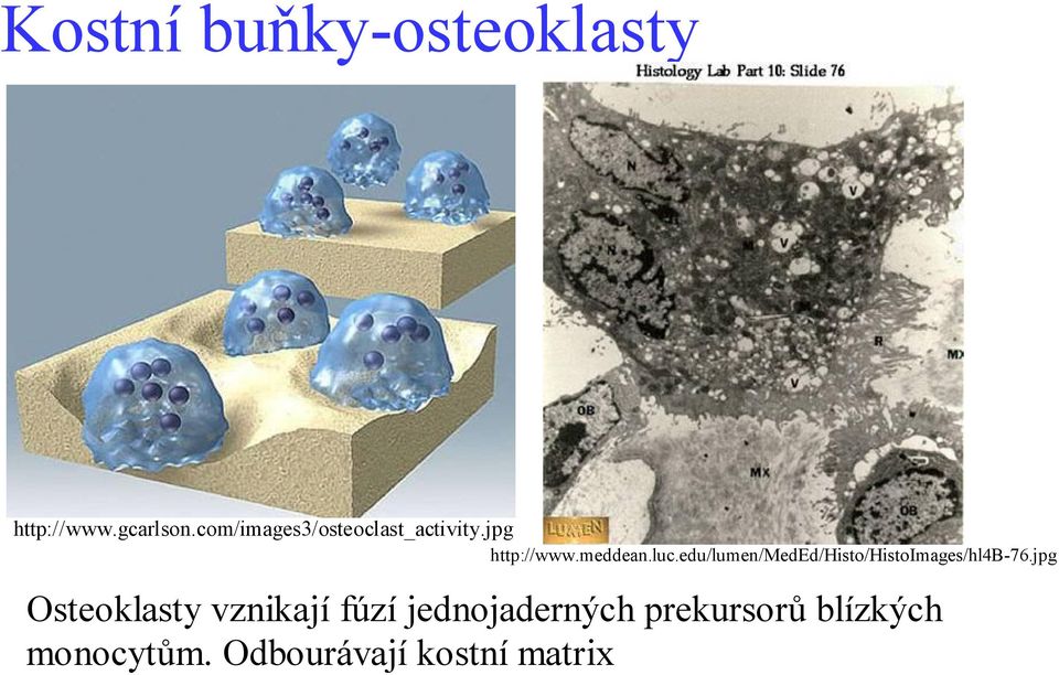 edu/lumen/meded/histo/histoimages/hl4b-76.