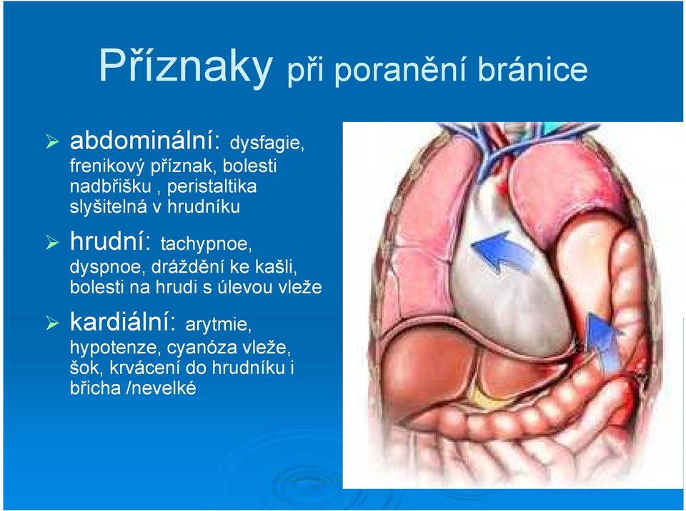 dyspnoe, dráždění ke kašli, bolesti na hrudi s úlevou vleže hrudní: