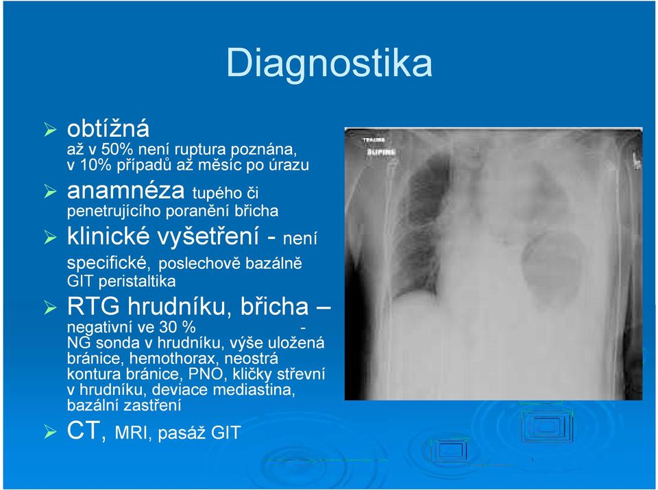 peristaltika RTG hrudníku, břicha negativní ve 30 % - NG sonda v hrudníku, výše uložená bránice,