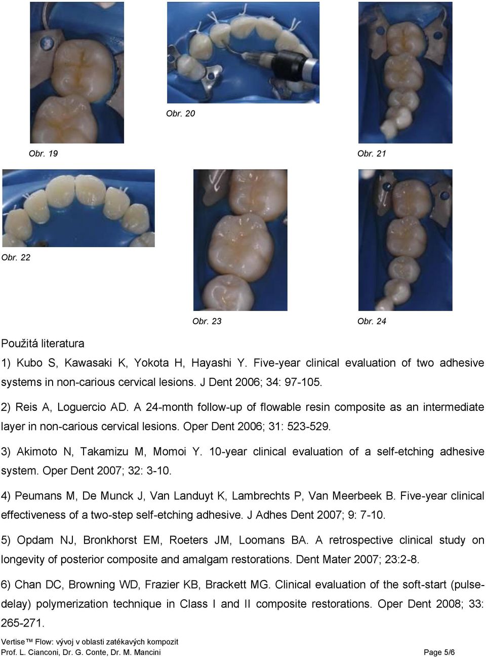 3) Akimoto N, Takamizu M, Momoi Y. 10-year clinical evaluation of a self-etching adhesive system. Oper Dent 2007; 32: 3-10. 4) Peumans M, De Munck J, Van Landuyt K, Lambrechts P, Van Meerbeek B.
