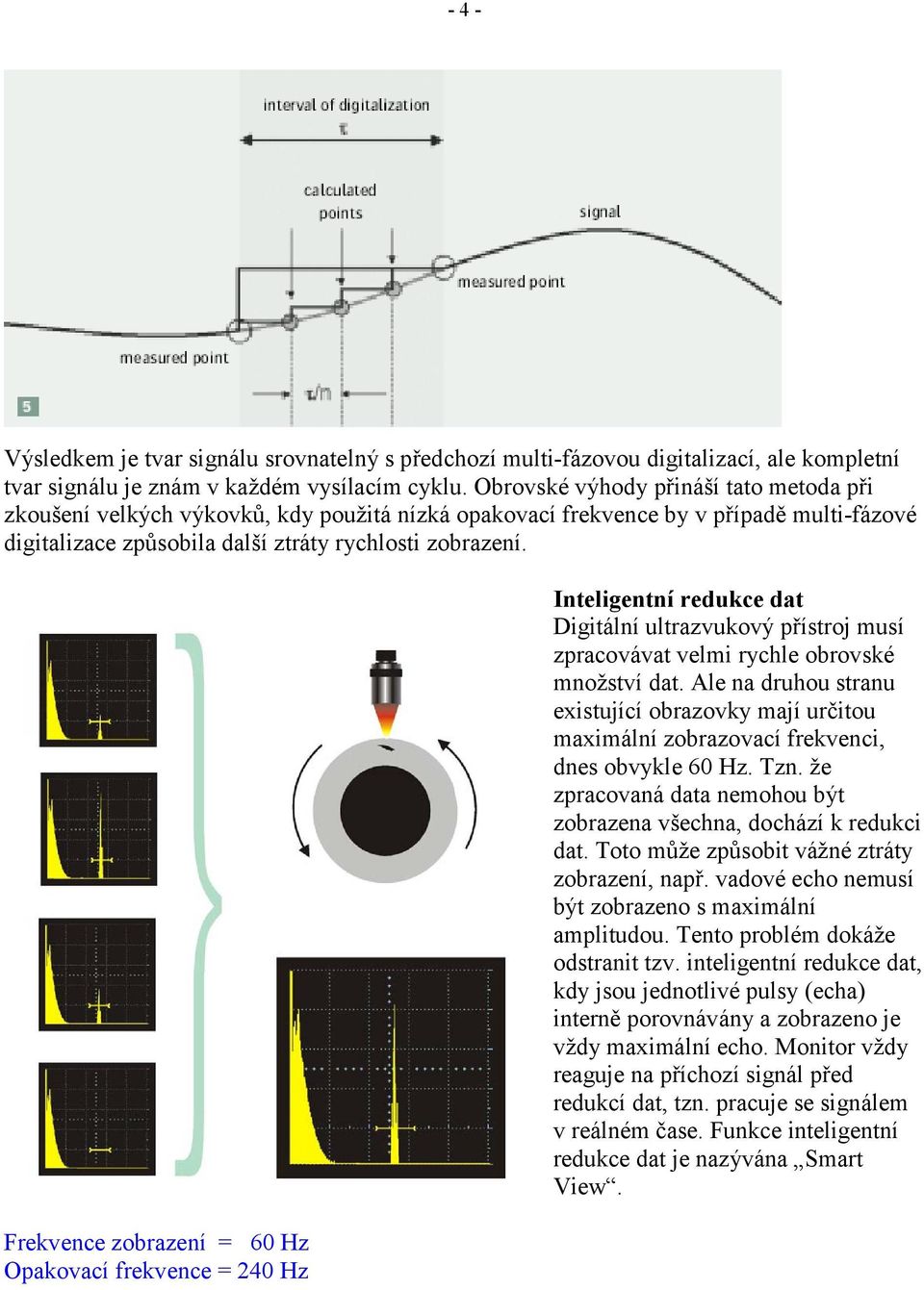 Frekvence zobrazení = 60 Hz Opakovací frekvence = 240 Hz Inteligentní redukce dat Digitální ultrazvukový přístroj musí zpracovávat velmi rychle obrovské množství dat.