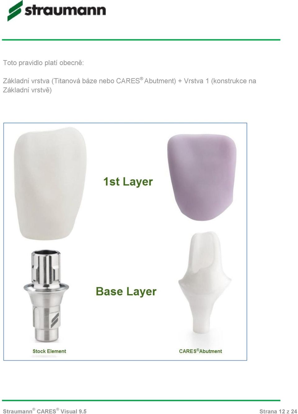 Abutment) + Vrstva 1 (konstrukce na