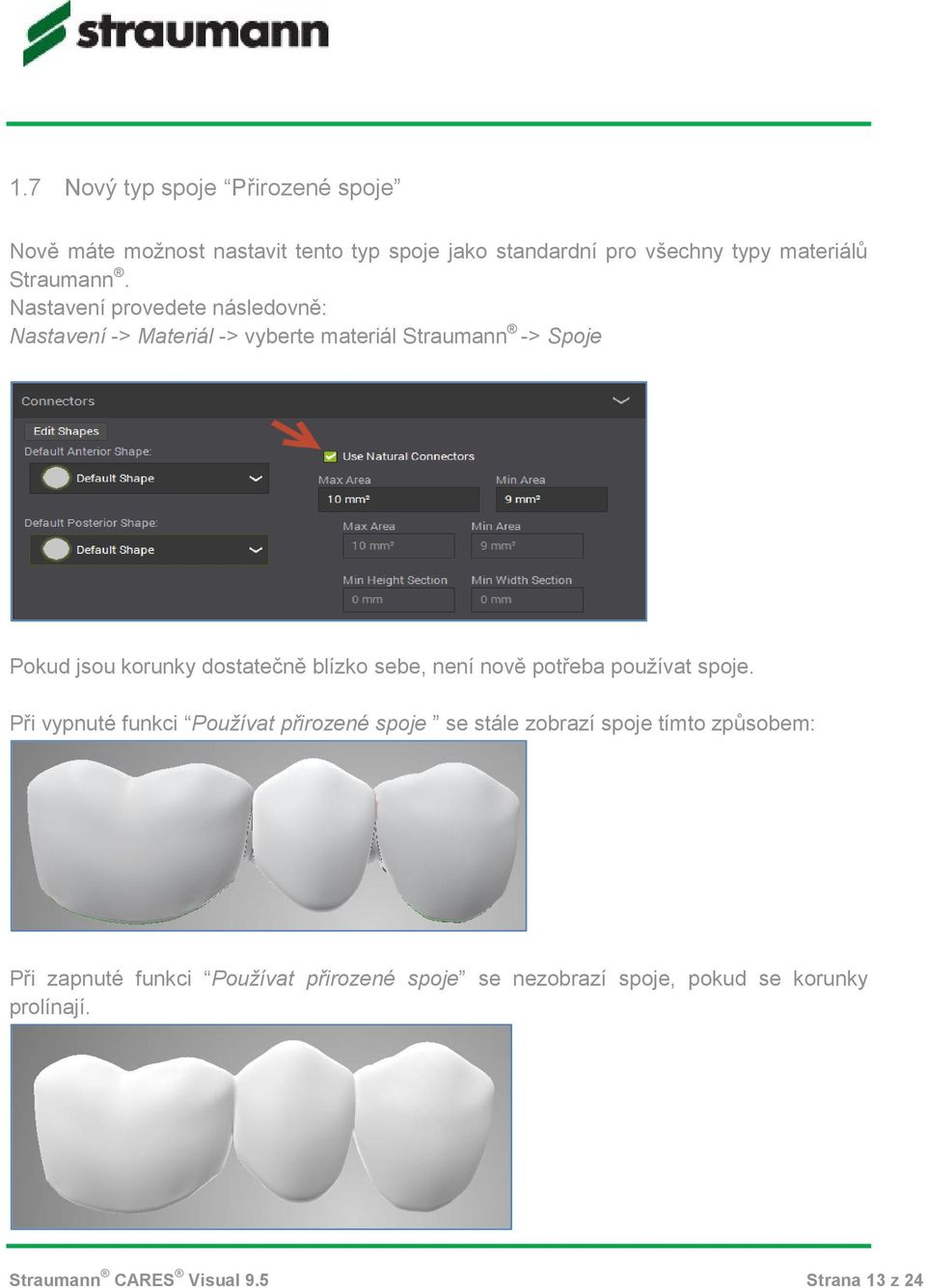Nastavení provedete následovně: Nastavení -> Materiál -> vyberte materiál Straumann -> Spoje Pokud jsou korunky dostatečně blízko