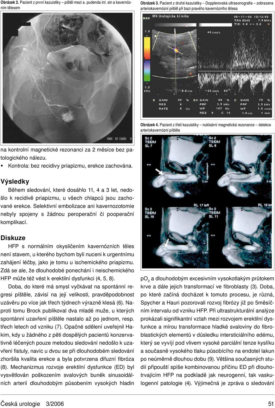 Pacient z třetí kazuistiky nukleární magnetická rezonance detekce arteriokavernózní píštěle na kontrolní magnetické rezonanci za 2 měsíce bez patologického nálezu.
