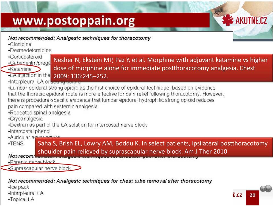 postthoracotomy analgesia. Chest 2009; 136:245 252.