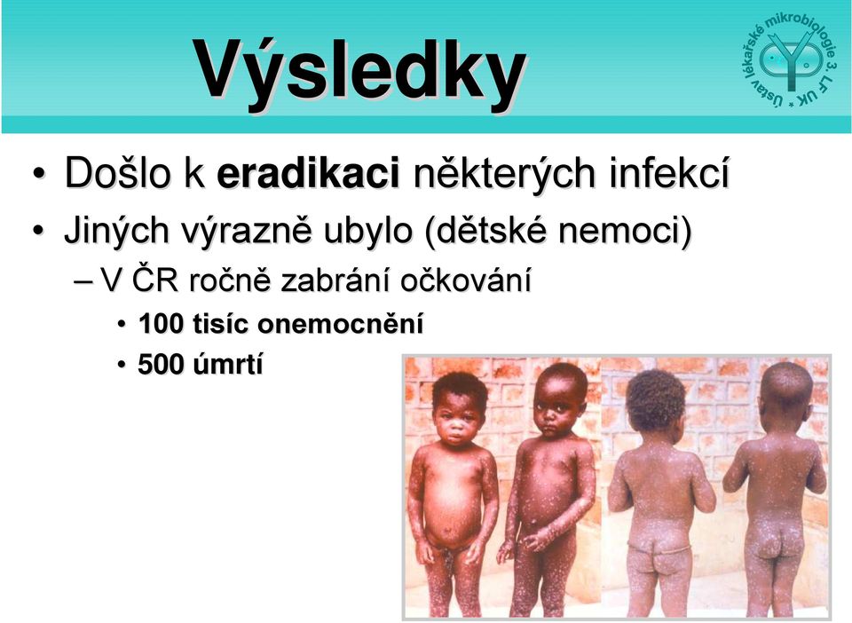 ubylo (dětské nemoci) V ČR ročně