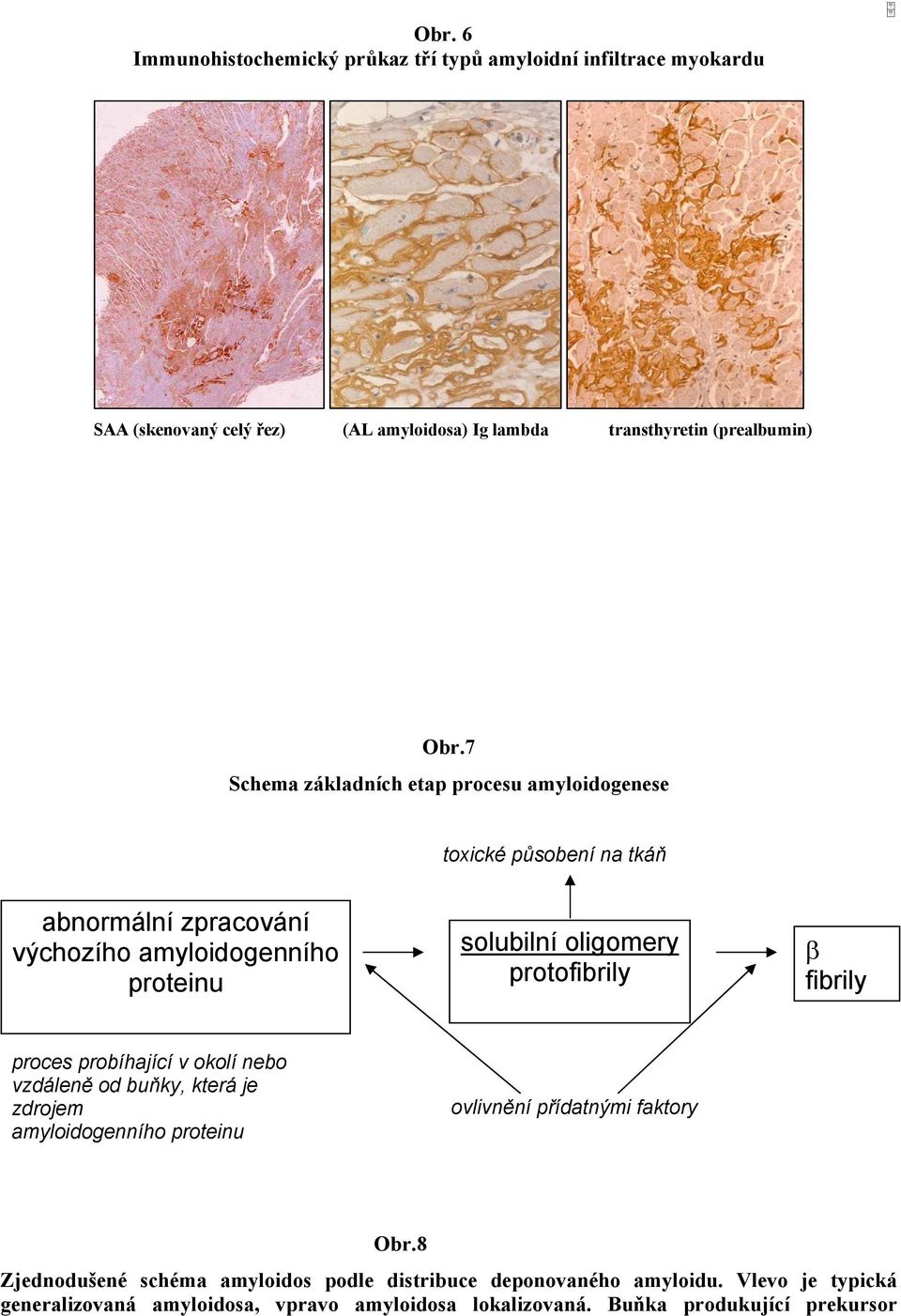 protofibrily β fibrily proces probíhající v okolí nebo vzdáleně od buňky, která je zdrojem amyloidogenního proteinu ovlivnění přídatnými faktory Obr.