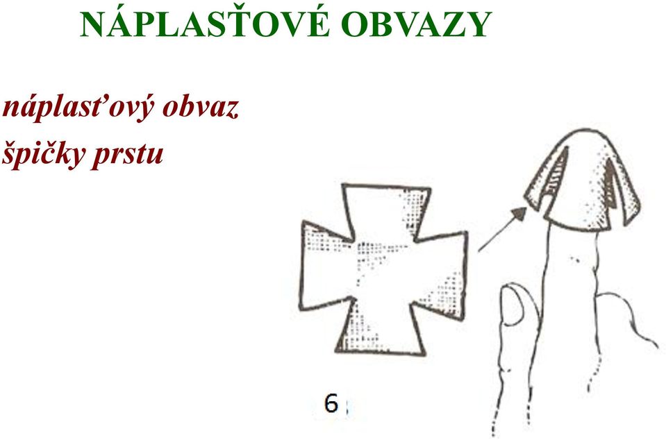 náplasťový