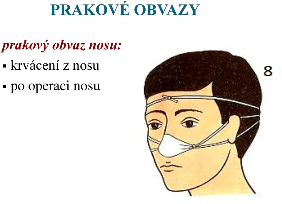 nosu: krvácení z