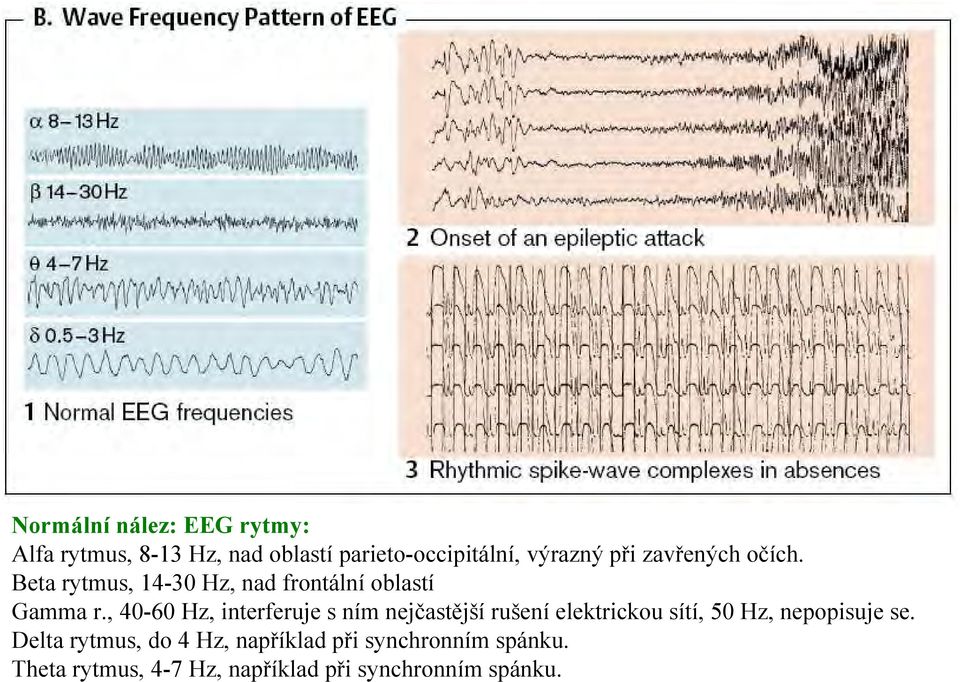 , 40-60 Hz, interferuje s ním nejčastější rušení elektrickou sítí, 50 Hz, nepopisuje se.