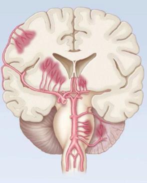 Time is Brain
