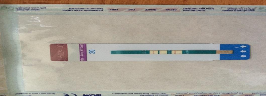 HIV Anti HIV 1 / 2, 1./3. trimestru Riziko infekce 5-30% dle viremie PCR HIV Antiretrovirotika nejpozději od 14.