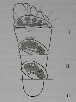 Obr.č. 7 Příčne klenutí nohy volně podle Kapandjiho (1987) v úseku: I. (přední příční oblouk) je tvořen hlavičkami metatarzálních kostí, vrchol klenutí je hlavička druhého metatarzu. II.