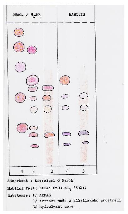 TLC reálný chromatogram Extrakt moče Systém J.