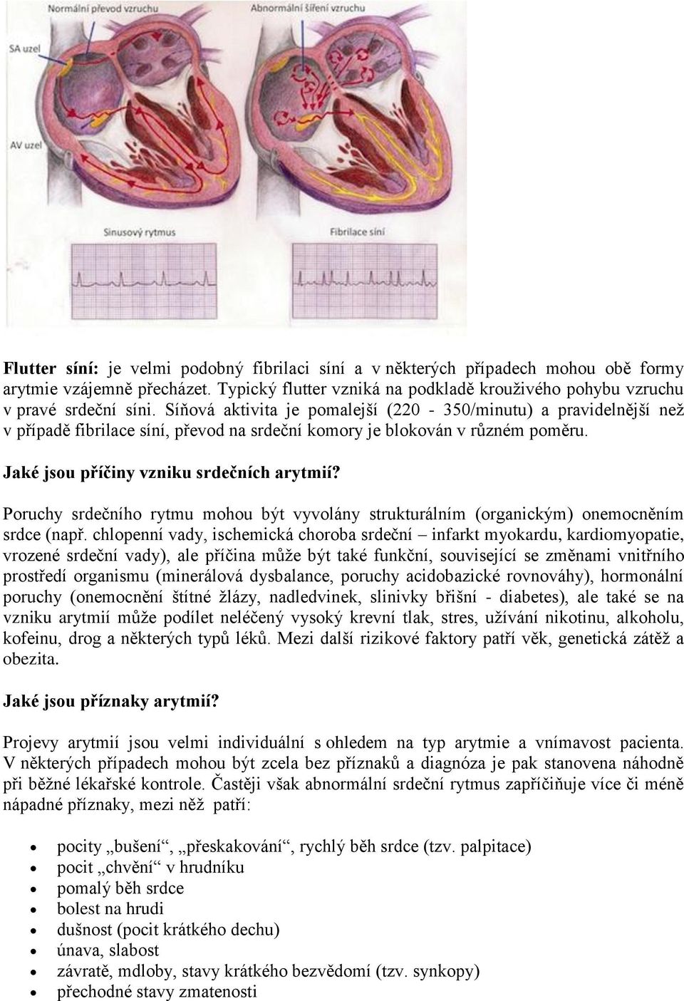 Poruchy srdečního rytmu mohou být vyvolány strukturálním (organickým) onemocněním srdce (např.