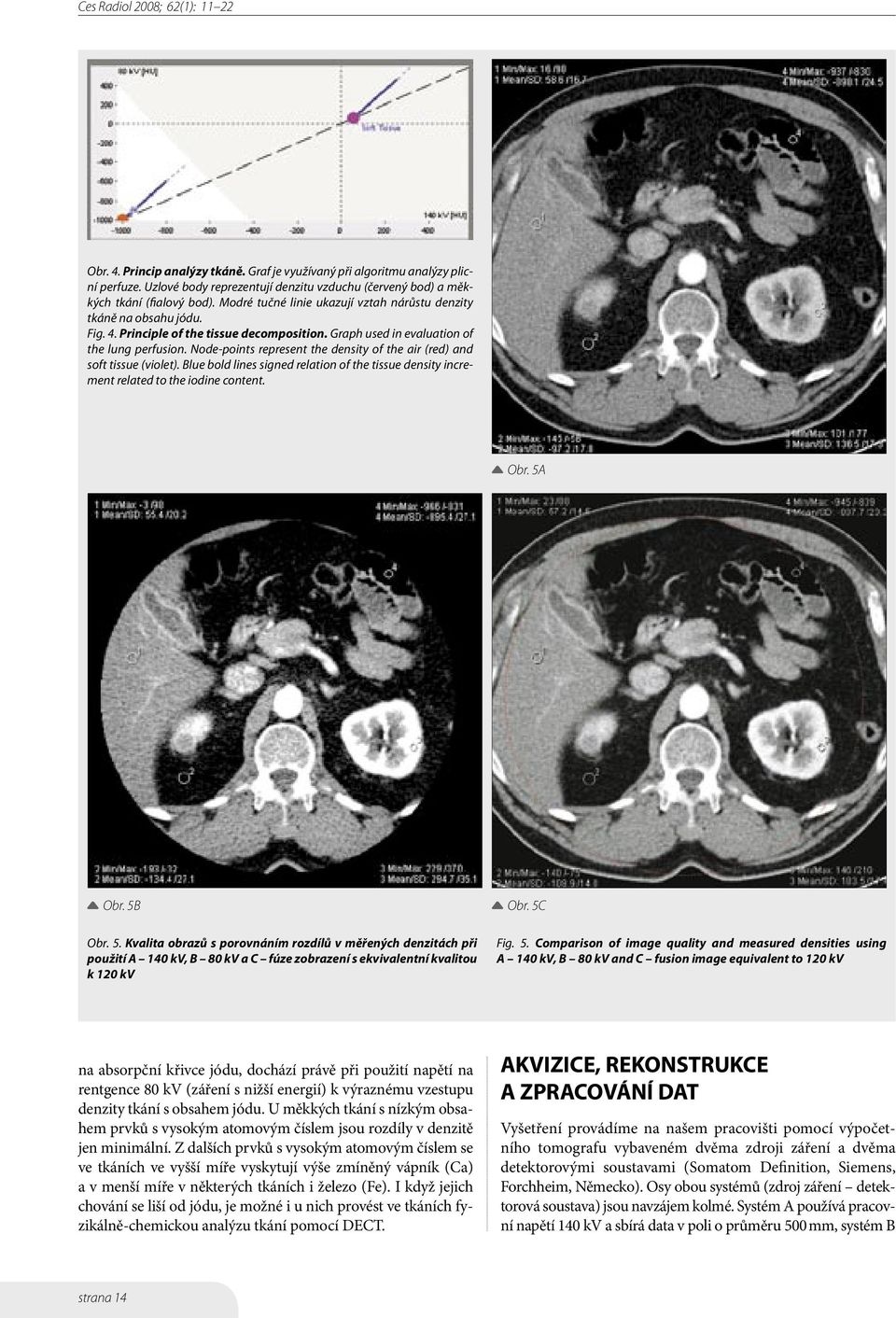 Node-points represent the density of the air (red) and soft tissue (violet). Blue bold lines signed relation of the tissue density increment related to the iodine content. Obr. 5A