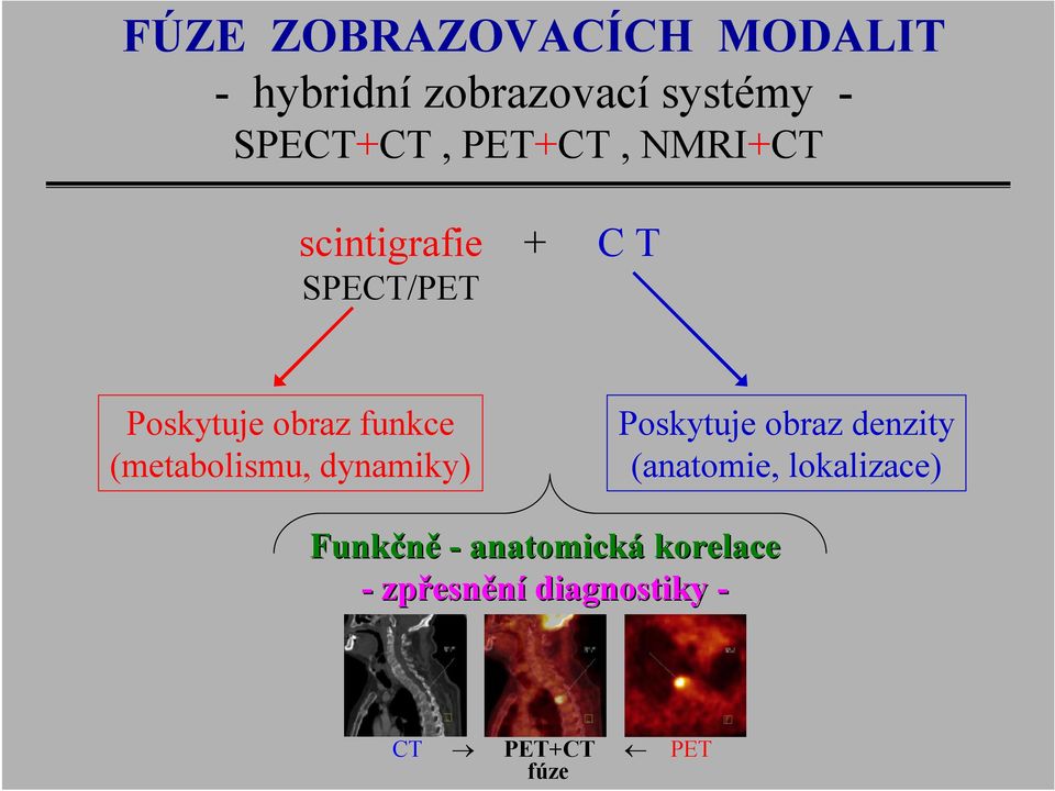 (metabolismu, dynamiky) Poskytuje obraz denzity (anatomie, lokalizace)